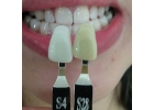 Косметическое отбеливание зубов MagicWhite